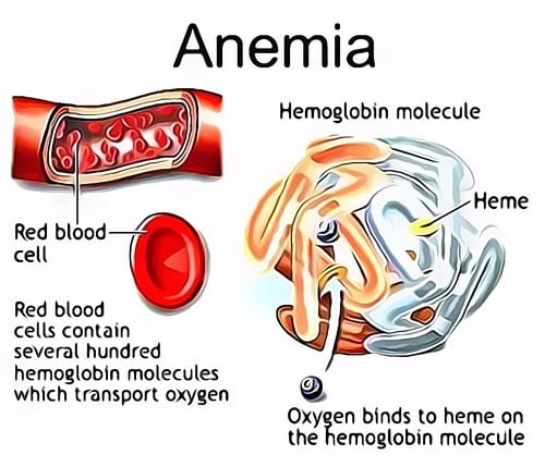 Obat Anemia Resep Herbal HNI HPAI
