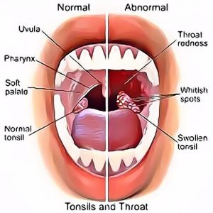 Obat Herbal Wasir Hpai